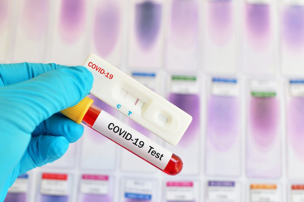 Healthcare worker holding COVID-19 Test. IMAGE SOURCE: GETY IMAGES Photo credit: Getty Images